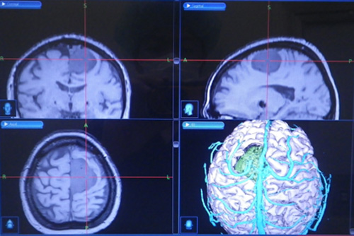 CTとMRIの画像から構築した3D画像イメージ