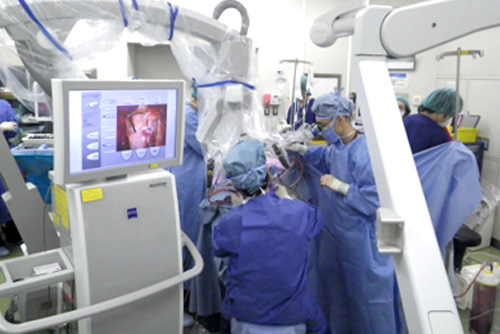 ナビゲーション装置を用いた脳外科の手術の様子イメージ
