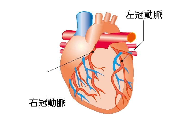 冠動脈イメージ